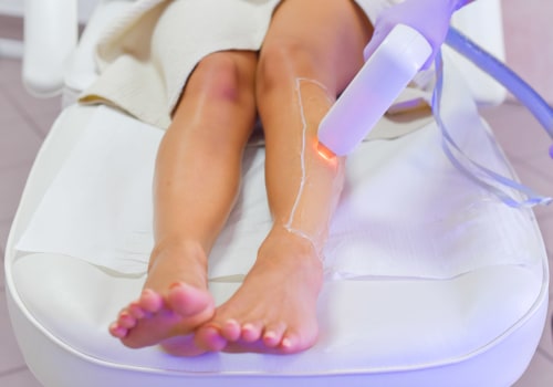 Making Laser Hair Removal Easier: A Comprehensive Guide
