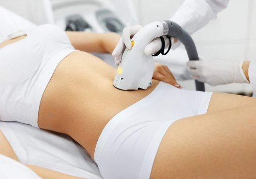 Reducing Pain and Discomfort from Laser Hair Removal Treatments