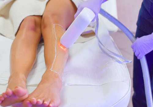 What are the Reasons You Can't Have Laser Hair Removal?