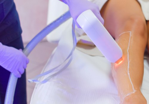 The Potential Long-Term Health Risks of Laser Hair Removal